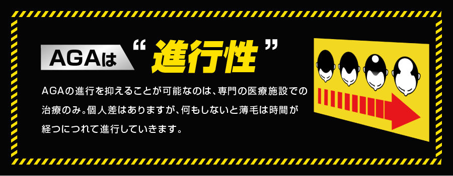 AGAは“進行性” AGAの進行を抑えることが可能なのは、専門の医療施設での治療のみ。個人差はありますが、何もしないと薄毛は時間が経つにつれて進行していきます。