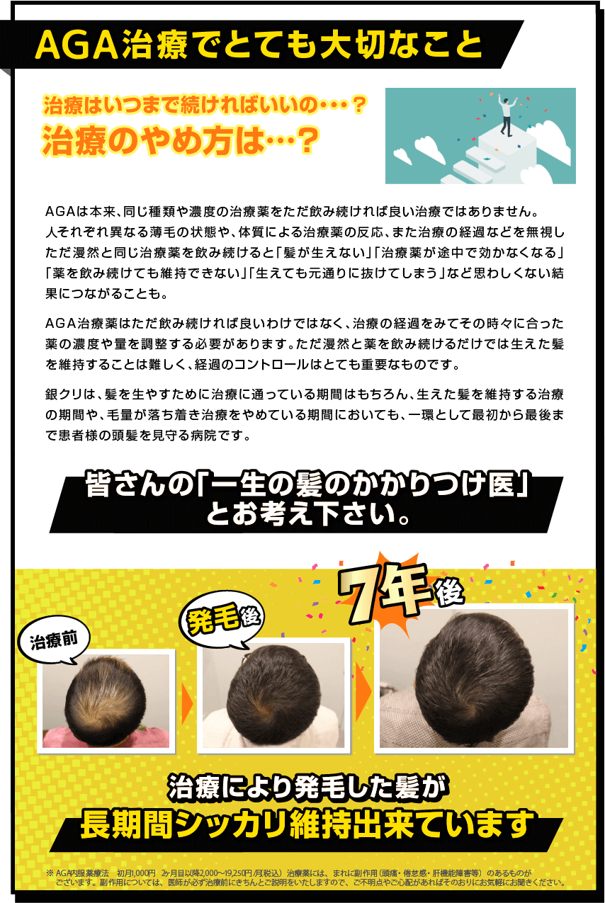 AGA治療でとても大切なこと 治療はいつまで続ければいいの…？治療のやめ方は…？ AGAは本来、同じ種類や濃度の治療薬をただ飲み続ければ良い治療ではありません。人それぞれ異なる薄毛の状態や、体質による治療薬の反応、また治療の経過などを無視したまま漫然と同じ治療薬を飲み続けると「髪が生えない」「治療薬が途中で効かなくなる」「薬を飲み続けても維持できない」「生えても元通りに抜けてしまう」など思わしくない結果につながることも。AGA治療薬はただ飲み続ければ良いわけではなく、治療の経過をみてその時々に合った薬の濃度や量を調整する必要があります。ただ漫然と薬を飲み続けるだけでは生えた髪を維持することは難しく、経過のコントロールはとても重要なものです。銀クリは、髪を生やすために治療に通っている期間はもちろん、生えた髪を維持する治療の期間や、毛量が落ち着き治療をやめている期間においても、一環として最初から最後まで患者様の頭髪を見守る病院です。皆さんの「一生の髪のかかりつけ医」とお考え下さい。改善から7年後 治療により発毛した髪が長期間シッカリ維持出来ています