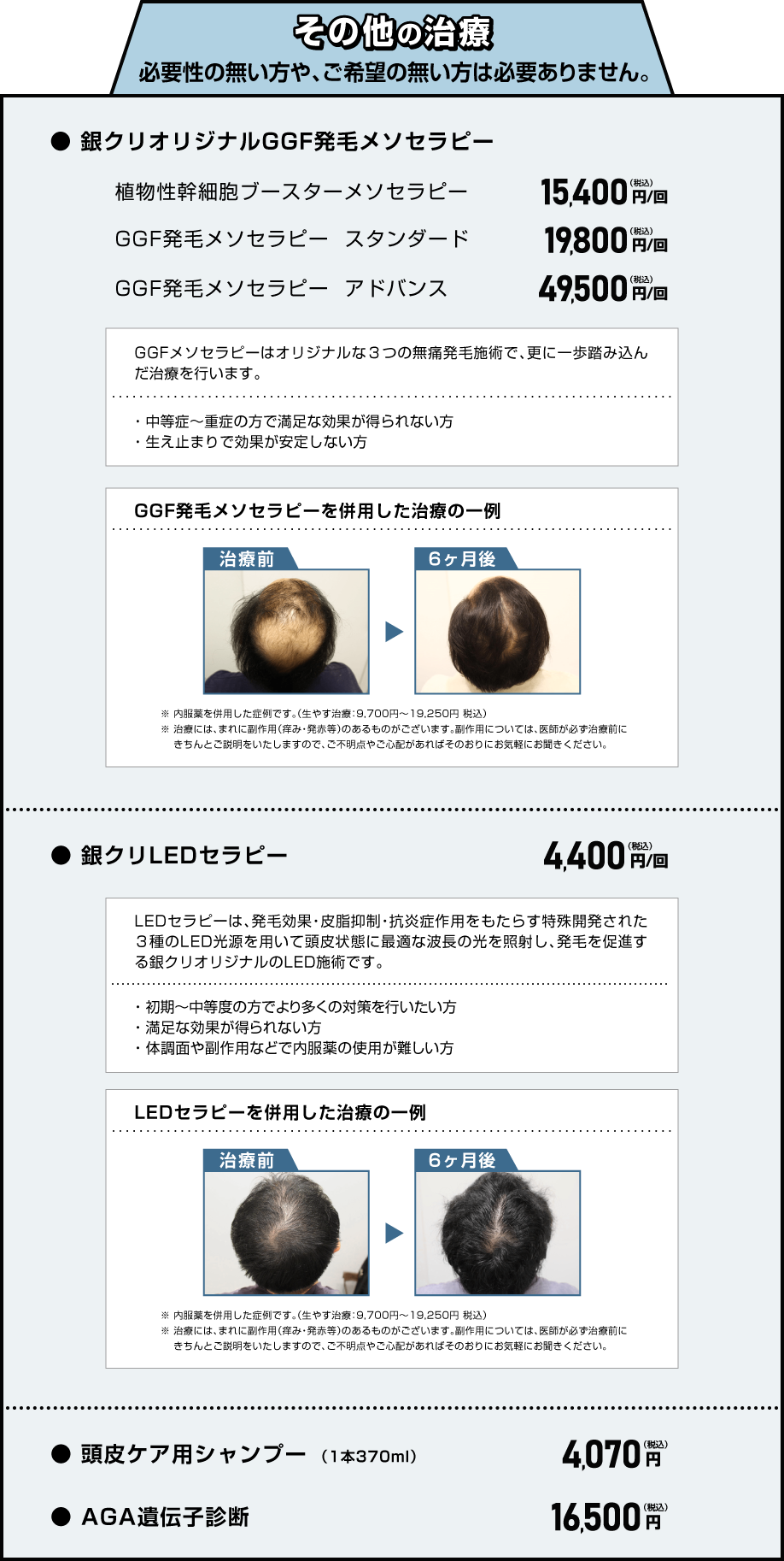 その他の治療 必要性の無い方や、ご希望の無い方は必要ありません。 ●銀クリオリジナルGGF発毛メソセラピー 植物性幹細胞ブースターメソセラピー 15,400円（税込）/回 GGF発毛メソセラピー スタンダード 19,800円（税込）/回 GGF発毛メソセラピー アドバンス 49,500円（税込）/回 GGFメソセラピーはオリジナルな3つの無痛発毛施術で、更に一歩踏み込んだ治療を行います。 ・中等症〜重症の方で満足な効果が得られない方 ・生え止まりで効果が安定しない方 ●銀クリLEDセラピー 4,400円（税込）/回 LEDセラピーは発毛効果、皮脂抑制、抗炎症作用をもたらす特殊開発された3種のLED光源を用いて頭皮状態に最適な波長の光を照射し、発毛を促進する銀クリオリジナルのLED施術です。 ・初期〜中等度の方でより多くの対策を行いたい方 ・満足な効果が得られない方 ・体調面や副作用などで内服薬の使用が難しい方 ●頭皮ケア用シャンプー（1本370ml） 4,070円（税込） ●AGA遺伝子診断 16,500円（税込）
